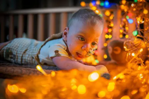 Chris Watt Photography Kobi is lying on his tummy. He has short blond hair and has a feeding tube in his nose. He is looking at fairy lights which are all over his bed.