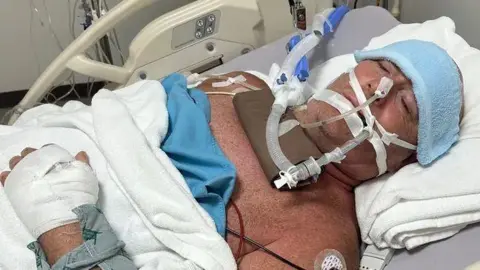 Lee Francis Lee Francis  is pictured on a ventilator in a hospital bed in Thailand