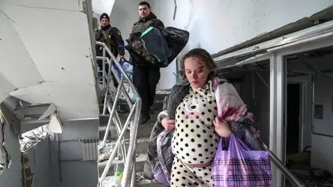 AP An injured pregnant woman walks downstairs in a maternity hospital damaged by shelling in Mariupol