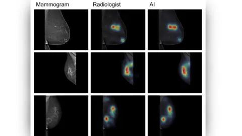 DR HANTAO LIU Cardiff University Medical images as seen by AI and a radiologist