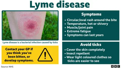 Text: Headline: Lyme disease. Symptoms: circular/oval rash around the bite. Temperature, hot or shivery. Muscle/joint pain. Extreme fatigue. Symptoms can last years. Avoid Ticks - cover the skin completely, insect repellent, wear light coloured clothes so ticks are easier to see. Contact your GP if you think you've been bitten, or develop symptoms. Photo: A picture of a person's calf, it has a deep red bite and a lighter ring around the edge of the bite. 