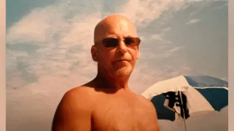 Diane Adams A man in his mid-50s is standing in the sunshine without a shirt on. You can just see the top of his chest and shoulders. In the background there is a sun umbrella. He is wearing sun glasses and the sky is blue with wispy clouds.