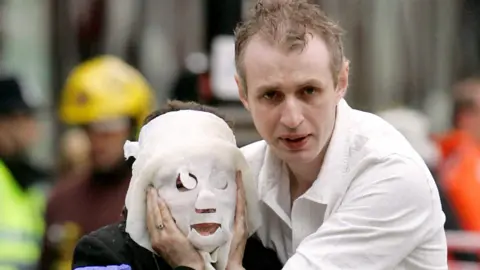 A woman wearing a burns mask to cover her face, walking through central London alongside a man with a worried expression, wearing a white shirt.