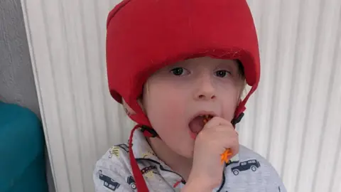 Family A young boy sits on a play mat wearing a soft red protective helmet fastened under his chin. He has blonde hair and is wearing grey pyjamas with a car print, and is holding a small orange toy near his mouth. A radiator is visible behind him.