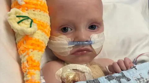 Macs Green is a small baby. He is lying in a hospital bed with a tube coming from his nose. He has an orange cuddly toy on his right