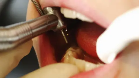 A close up of a child's mouth at the dentist - the dentist's fingers, with white gloves on, are visible, along with a drill