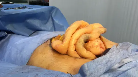 Operation simulation