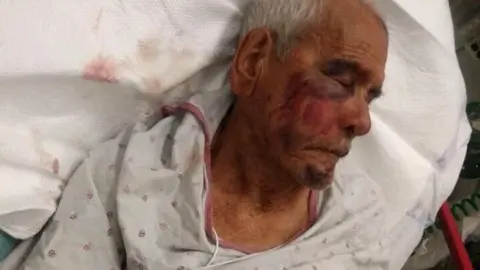 Erik Mendoza/GoFundMe Photo of Mr Rodriguez in hospital bed