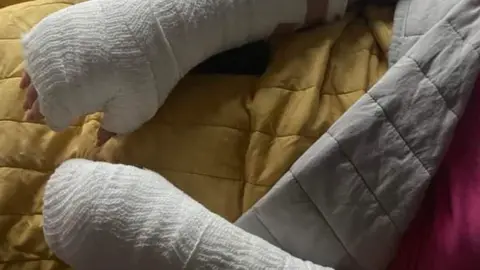 Katie Deere Katie Deere suffered injuries to both her arms during a dog attack