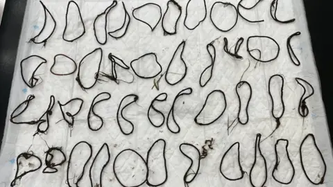 Vetpartners Hairbands removed from Tiger's stomach