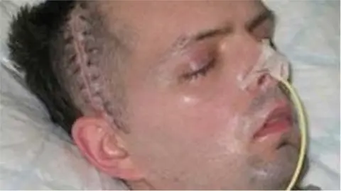 Londonderry civil servant Paul McCauley after he was beaten up in a sectarian attack in July 2006