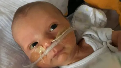 Family handout  Baby Orlando Davis, who died 14 days after being born by emergency caesarean