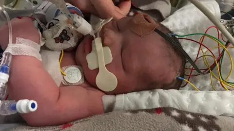 Eleanor Taylor-Verlaan Baby Alissa connected to wires and tubes in an incubator in hospital