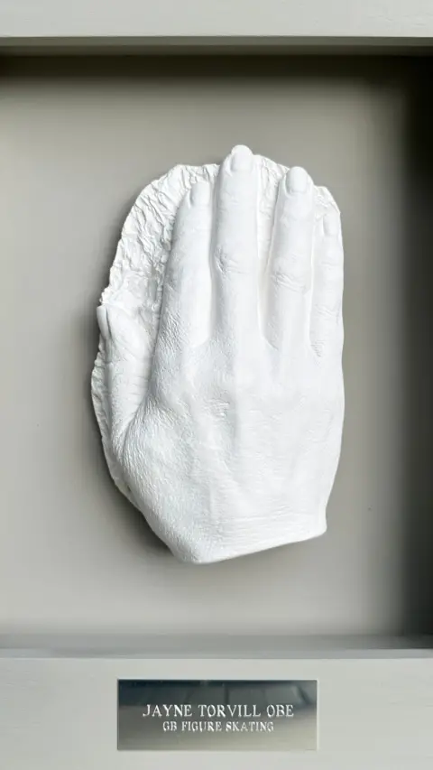 Louise Giblin A cast of Jayne Torvill's hand