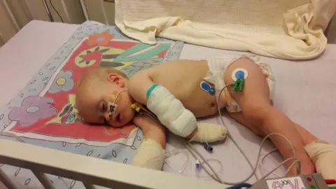 Lynda Davies Lyidan aged one in a hospital bed, in just a nappy. A number of wires are attached to him, a tube up his nose, and his arm and hands bandaged.