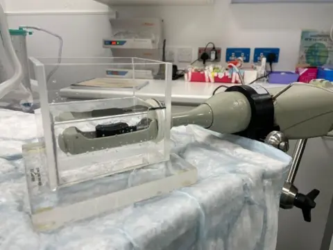 A focal therapy probe on a surface in a medical room which uses high intensity ultrasound.