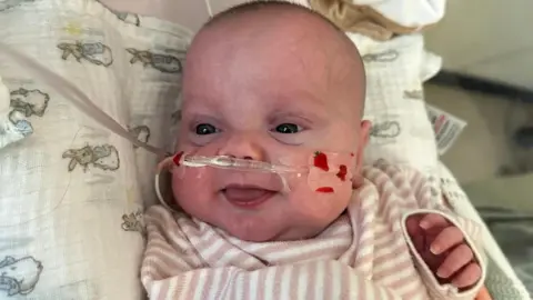 A baby with a drip up its nose is smiling. She is wearing a striped top and is lying on a pillow with rabbits on it