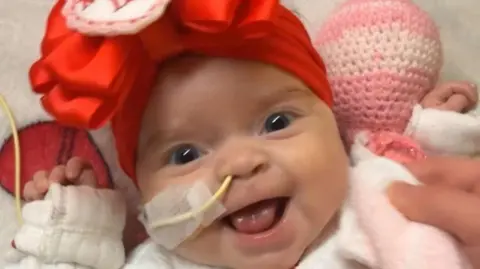 A young baby wearing a white babygrow it smiles at the camera. The baby has a yellow hospital tube coming out of her nose and has a red bow on her head.