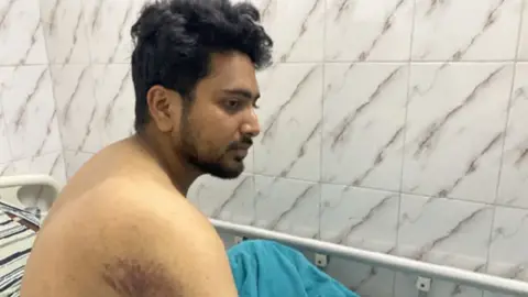 BBC Bangla Nahid Islam shows his injuries 