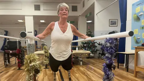 Kim Smith Kim Smith using her prosthetic legs