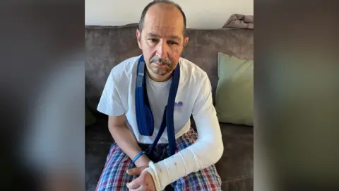 A picture of Gianni with a grazed face and his broken elbow in a sling