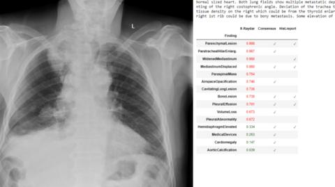 An example of the software scanning a chest X-ray