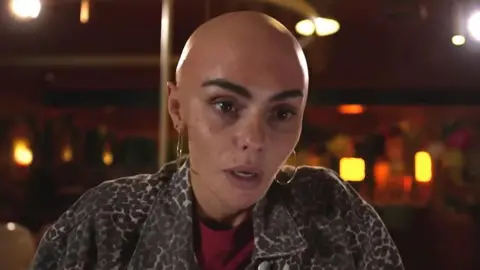 Lime Pictures/Channel 4 Hollyoaks character Mercedes McQueen played by actress Jennifer Metcalfe is seen without any hair