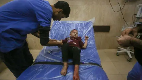 Getty Images An injured child with bare feet lies on a green bed covered with light plastic sheets, while a doctor in blue overalls bends over him and holds his right arm.