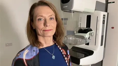 Ian Palmer/BBC Dr Olga Strukowska, Consultant Radiologist and Director of West Sussex Screening service. Dr Strukowska is stood in front of the screening machine. She is wearing a patterned shawl and navy top. She has long brown hair.