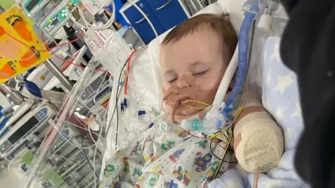 Libby Reynolds Baby Ritchie in a clear plastic hospital crib. Tubes and wires are attached to his face and body. His amputated arm is heavily bandaged. Hospital machines can be seen behind him.