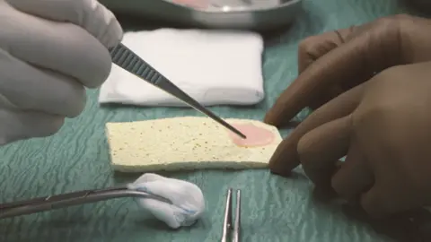 University Hospital Schleswig-Holstein is a close-up image of a pink-colored lab-gro patch of heart muscle sitting on a yellow sponge, which is being picked up by a surgeon wearing gloves and holding the tweezers