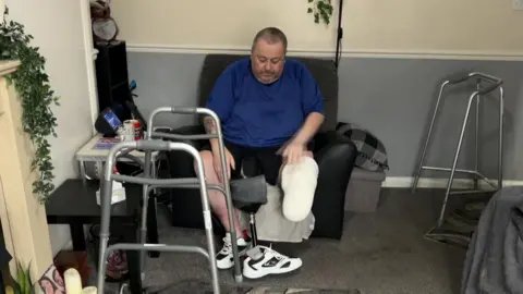 A man sits in a chair strapping a prosthetic to his left leg. There are grey carpets and black furniture in the room. He also has two walking aids.