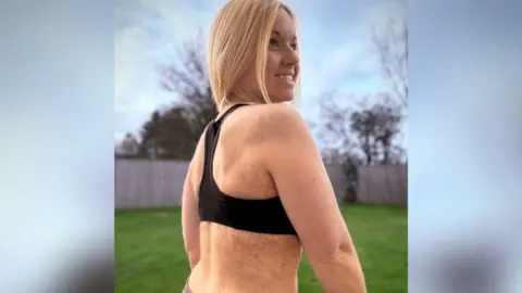 Jodi Whitehouse Helen Stroud is wearing a sports crop top showing her back, which has a slightly darker tone to it, showing the light scarring of surgeries. She has her blonde hair loosely tied back and is smiling as she turns her head to the right. She is standing in a garden with grass in the background and a fence. 