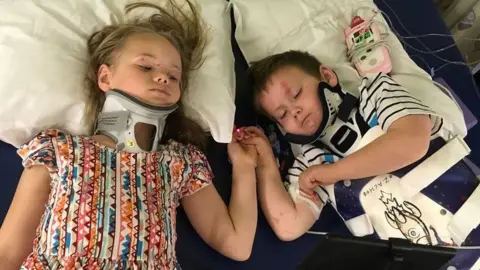 Teresa Burrell A boy and girl lie in a hospital bed. They have braces on their necks and bodies, with other medical equipment equipment in sight. Yet they lie with their eyes half-closed, holding each others' hand in an extremely moving image.