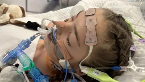 Rebecca Bannister Jasmine during surgery lying a hospital bed with wires attached to her mouth.