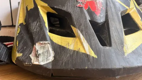 Jaime Owen The front of a black and yellow bike helmet, covered in scratches and showing a large dint on the front right side. 