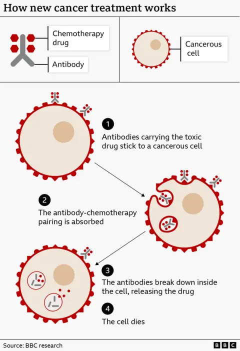 An infographic titled “How new cancer treatment works” explains a targeted therapy combining antibodies and chemotherapy drugs to attack cancer cells. At the top left, a diagram labels two components: a “Chemotherapy drug” shown as small red shapes, and an “Antibody” shown as a Y‑shaped grey structure. At the top right is a diagram of a “Cancerous cell,” shown as a large circular cell with a textured interior and a central nucleus, surrounded by a red outer edge. Below, the process is shown in four numbered steps with diagrams: “Antibodies carrying the toxic drug stick to a cancerous cell.” Small grey antibody shapes with attached red drug molecules are shown attaching to the surface of a large cancer cell. “The antibody‑chemotherapy pairing is absorbed.” The cell begins to engulf the attached antibody‑drug complexes, shown moving into the cell. “The antibodies break down inside the cell, releasing the drug.” Inside the cell, the antibody structures are shown breaking apart and releasing the red drug particles. “The cell dies.” The implication is that the released drug kills the cancer cell. The diagrams use simple colours: grey for antibodies, red for drug particles and the outer cell membrane, and beige tones for the cell interior. Arrows connect the stages to show progression. At the bottom, the source reads “BBC research,” with BBC branding in the corner.