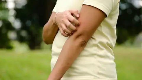 Woman in yellow t-shirt scratches her arm