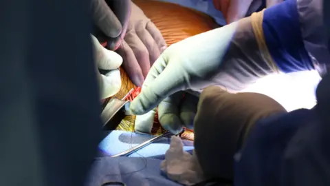 Massachusetts General Hospital Surgeons operating