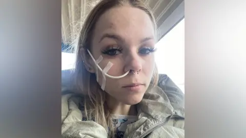 Grace Roy Girl with a nasogastric tube