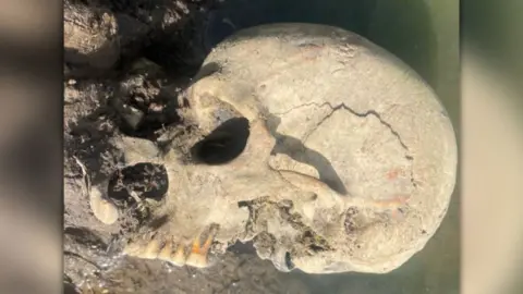 Image of a human skull