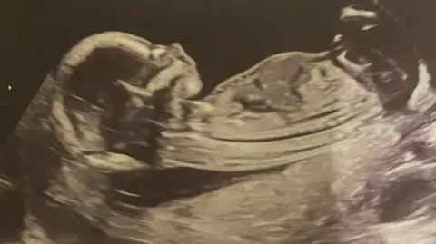 Ash Carter An early baby scan picture in sepia.