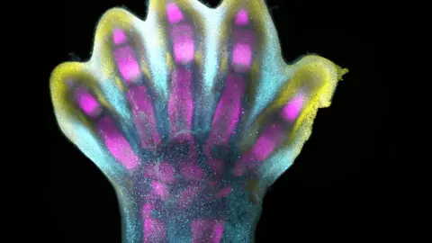 Alain Chadottel and Raphael Blain, Inserm an evolving human foot. Dots of different colors are genes that make bones, muscles and cartilage