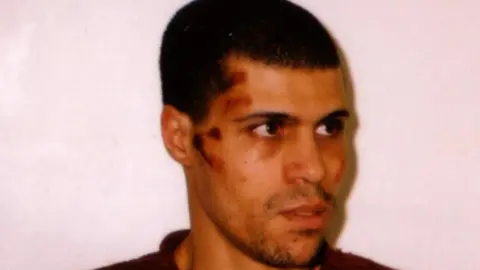 Kamal Bourgass has short cropped hair and scars on the right hand side of his face.