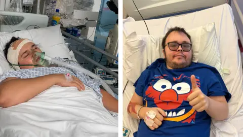 A composite image of two photos of the same man. On the left, he lies with his eyes closed in a hospital bed with an oxygen mask over his mouth and a large bandage around his head. On the right, he lies in a hospital bed wearing an Elmo t-shirt, doing a thumbs up to the camera.