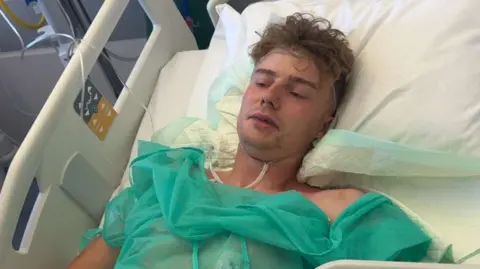 A man lying in a hospital bed. He is attached to tubes and wearing a green gown.