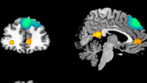University of Essex Brain scan images