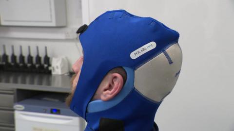 PolarCap brain-cooling treatment