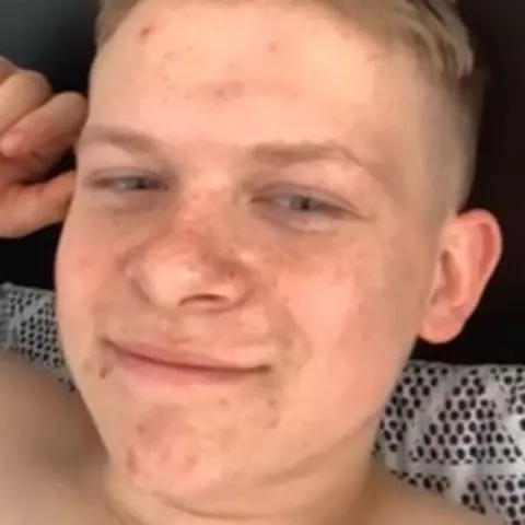 Lisa Collins A teenage boy with blonde hair pictured close up to his face.