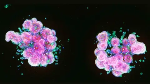 Microscopic image showing two clusters of pink and purple lab-grown cells, known as organoids, surrounded by smaller blue and green cells against a black background.